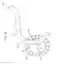 Fig. 40 - Method and apparatus for total knee arthroplasty