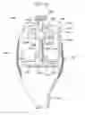 Fig. 44 - Method and apparatus for total knee arthroplasty