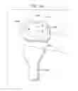 Fig. 45 - Method and apparatus for total knee arthroplasty