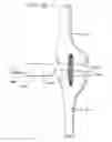 Fig. 46 - Method and apparatus for total knee arthroplasty