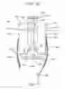 Fig. 50 - Method and apparatus for total knee arthroplasty