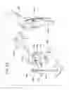Fig. 51 - Method and apparatus for total knee arthroplasty