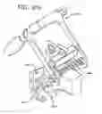 Fig. 57 - Method and apparatus for total knee arthroplasty
