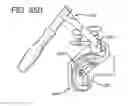 Fig. 58 - Method and apparatus for total knee arthroplasty