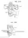 Fig. 61 - Method and apparatus for total knee arthroplasty