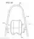 Fig. 62 - Method and apparatus for total knee arthroplasty