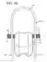 Fig. 63 - Method and apparatus for total knee arthroplasty