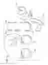 Fig. 65 - Method and apparatus for total knee arthroplasty