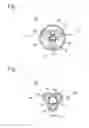 Fig. 03 - Balloon with different compression portions