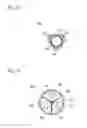Fig. 13 - Balloon with different compression portions