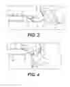 Fig. 03 - INVERTABLE MEDICAL RETRIEVAL DEVICES AND METHODS