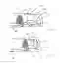 Fig. 06 - Calculus retrieving/removing device and method