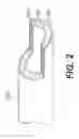 Fig. 03 - Endovascular devices and methods