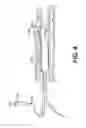 Fig. 05 - Endovascular devices and methods