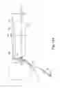 Fig. 14 - Needle handling device and a method for implanting a penile prosthetic insert