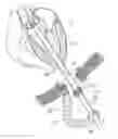 Fig. 01 - SURGICAL STABILIZER AND CLOSURE SYSTEM