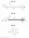 Fig. 04 - SURGICAL STABILIZER AND CLOSURE SYSTEM