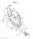 Fig. 08 - SURGICAL STABILIZER AND CLOSURE SYSTEM