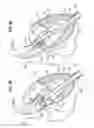Fig. 09 - SURGICAL STABILIZER AND CLOSURE SYSTEM
