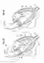 Fig. 10 - SURGICAL STABILIZER AND CLOSURE SYSTEM