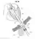 Fig. 12 - SURGICAL STABILIZER AND CLOSURE SYSTEM
