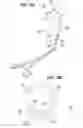 Fig. 13 - SURGICAL STABILIZER AND CLOSURE SYSTEM