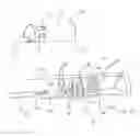 Fig. 03 - Calculus retrieving/removing device and method