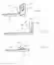 Fig. 08 - Calculus retrieving/removing device and method