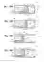 Fig. 10 - Calculus retrieving/removing device and method