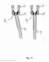 Fig. 11 - Orthopedic implant kit