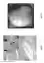 Fig. 15 - Orthopedic implant kit