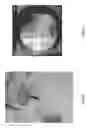 Fig. 16 - Orthopedic implant kit