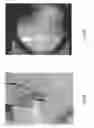 Fig. 17 - Orthopedic implant kit