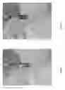 Fig. 19 - Orthopedic implant kit