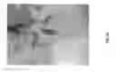 Fig. 20 - Orthopedic implant kit