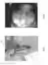 Fig. 22 - Orthopedic implant kit