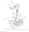 Fig. 01 - SPINAL IMPLANT SYSTEM AND METHOD