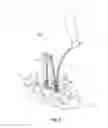 Fig. 14 - SPINAL IMPLANT SYSTEM AND METHOD