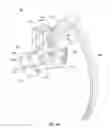 Fig. 17 - SPINAL IMPLANT SYSTEM AND METHOD
