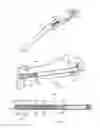 Fig. 02 - Intramedullary fracture fixation devices and methods