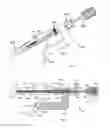 Fig. 03 - Intramedullary fracture fixation devices and methods