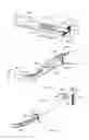 Fig. 06 - Intramedullary fracture fixation devices and methods