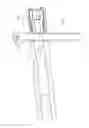 Fig. 27 - Intramedullary fracture fixation devices and methods