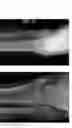 Fig. 36 - Intramedullary fracture fixation devices and methods