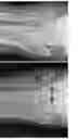Fig. 37 - Intramedullary fracture fixation devices and methods