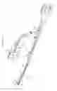 Fig. 42 - Intramedullary fracture fixation devices and methods
