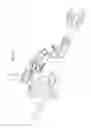 Fig. 46 - Intramedullary fracture fixation devices and methods