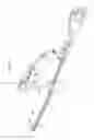 Fig. 47 - Intramedullary fracture fixation devices and methods