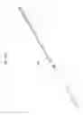 Fig. 56 - Intramedullary fracture fixation devices and methods