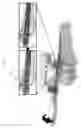Fig. 67 - Intramedullary fracture fixation devices and methods